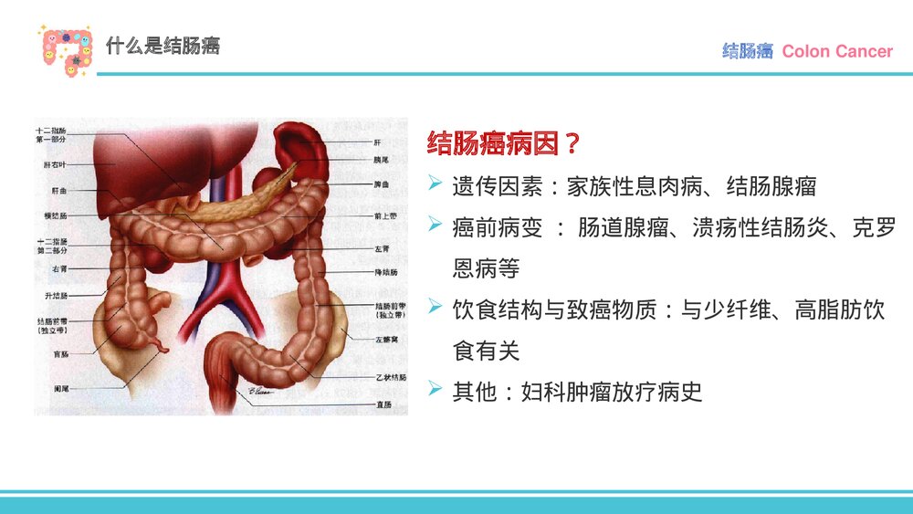 结肠癌的围术期护理PPT课件（电子版·带内容·可编辑修改）7