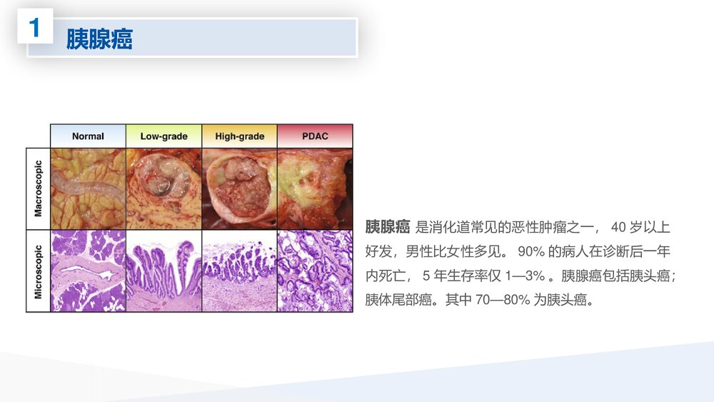 腹腔镜胰体尾切除术护理查房PPT课件下载5