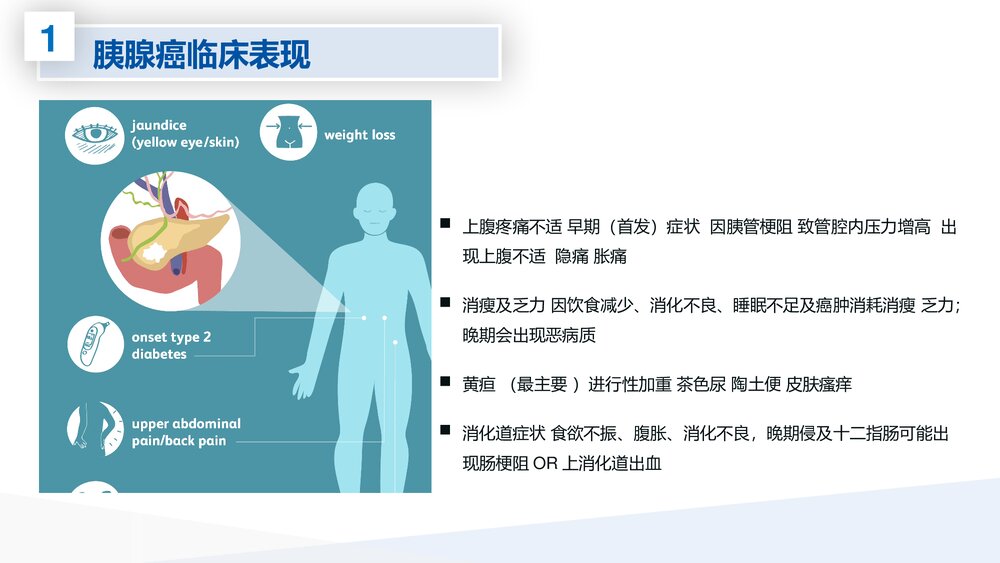 腹腔镜胰体尾切除术护理查房PPT课件下载6