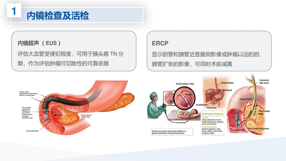腹腔镜胰体尾切除术护理查房PPT课件下载10