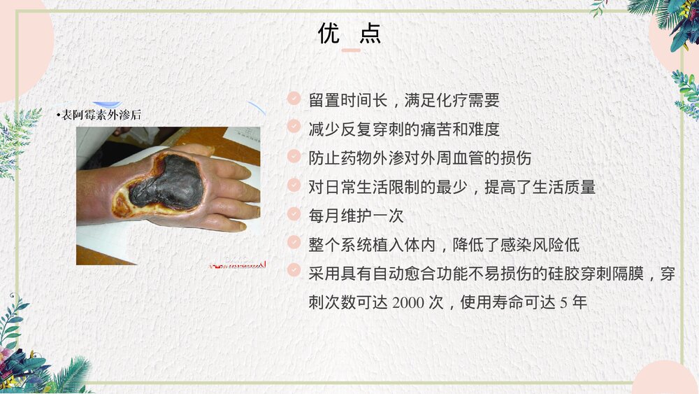 静脉输液港的维护和使用PPT课件(带内容·可编辑修改）5