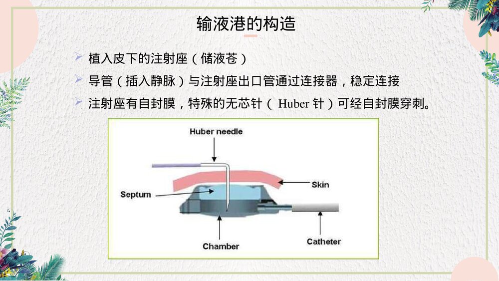 静脉输液港的维护和使用PPT课件(带内容·可编辑修改）10