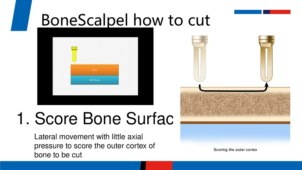 超声骨刀PPT课件(英文版)5