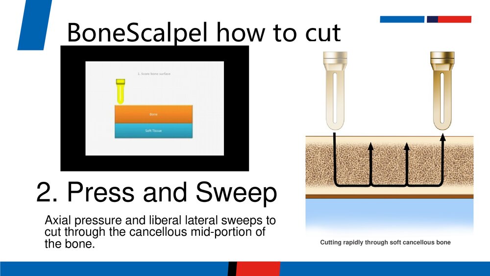 超声骨刀PPT课件(英文版)6