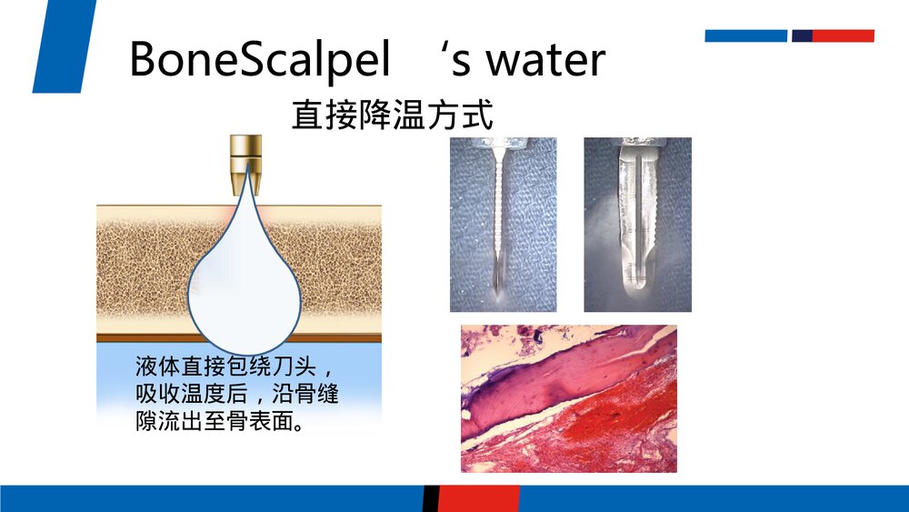 超声骨刀PPT课件(英文版)10