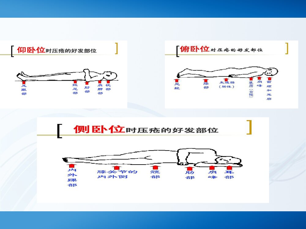 手术室压疮PPT课件(带内容)9
