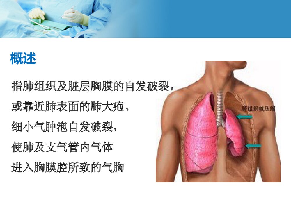 自发性气胸护理教学查房PPT课件下载3