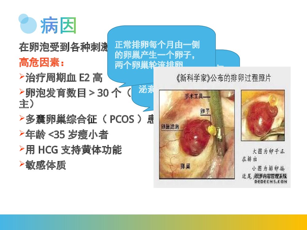 卵巢过度刺激综合征PPT课件(带内容)5