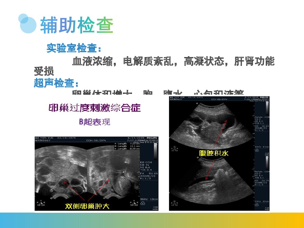 卵巢过度刺激综合征PPT课件(带内容)8