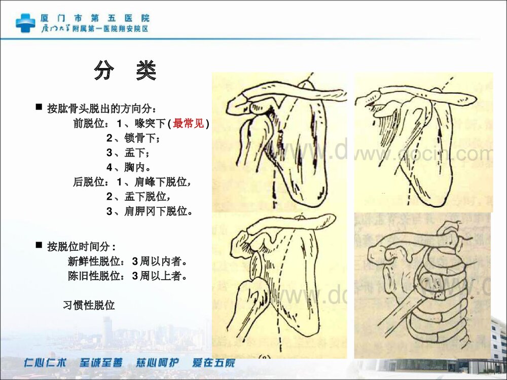 肩关节镜检盂唇修补关节清理术手术配合PPT课件9