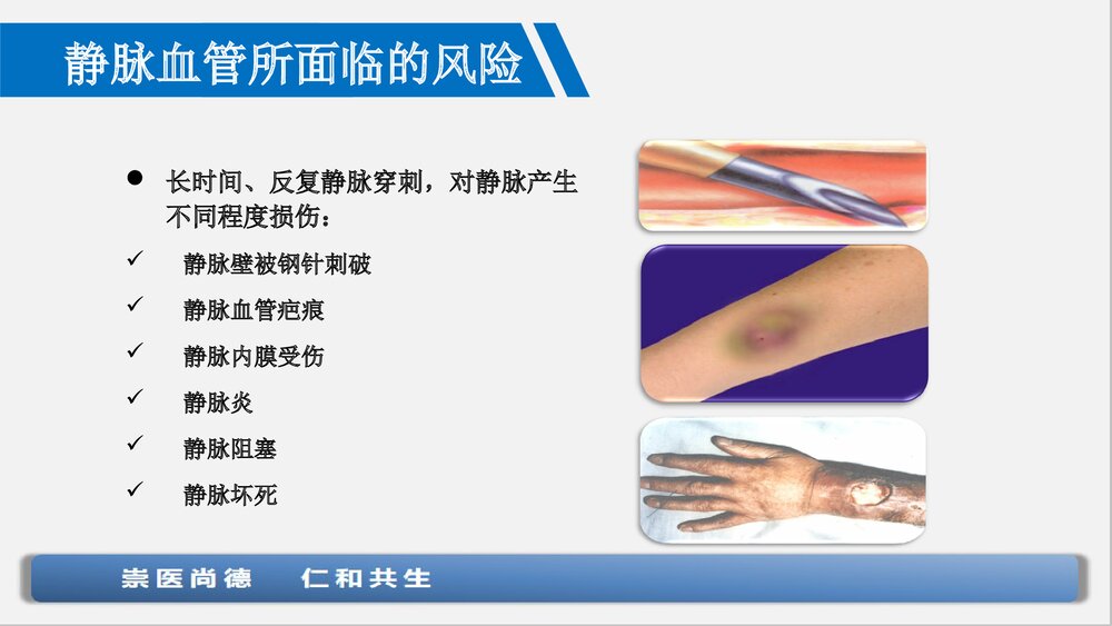 血管保护与输液工具合理选择PPT课件下载5