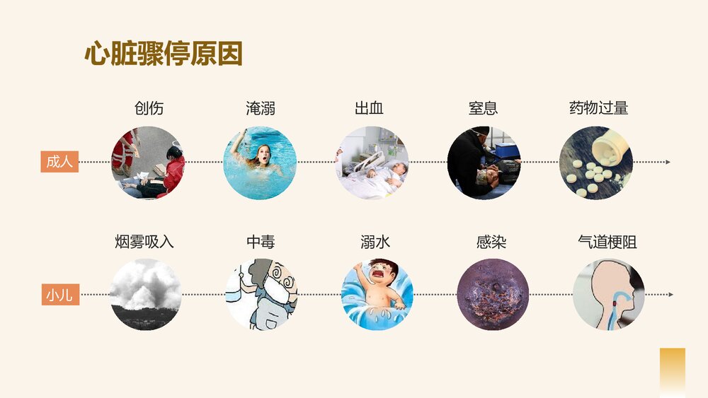 心脏骤停的应对方法以及心肺复苏的应对操作PPT课件下载5