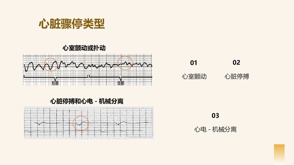 心脏骤停的应对方法以及心肺复苏的应对操作PPT课件下载6
