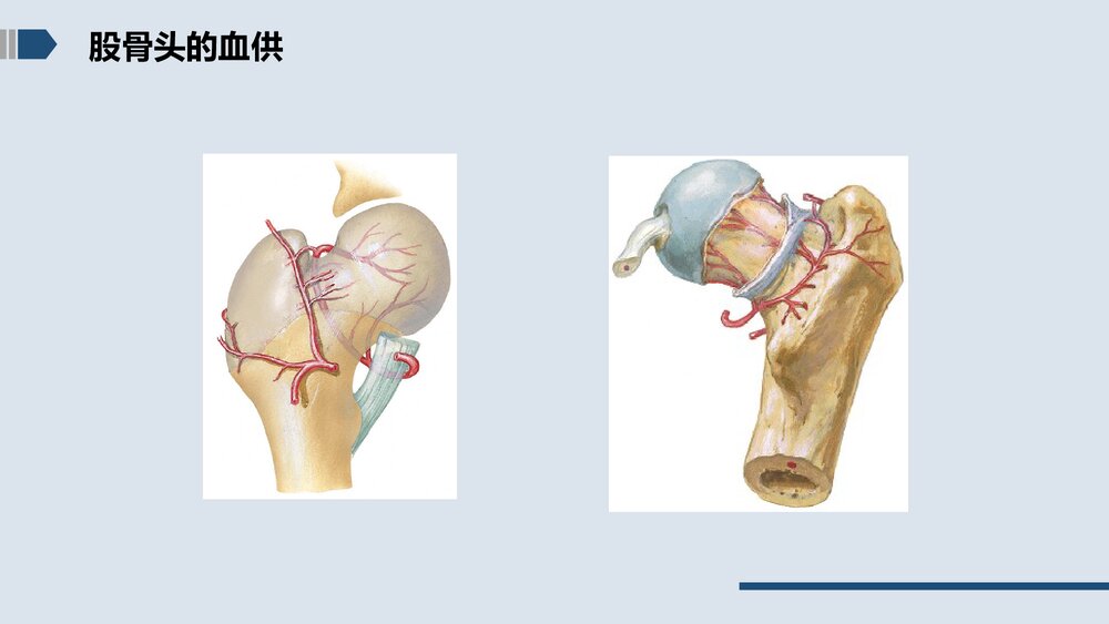 股骨颈骨折的护理PPT课件下载8