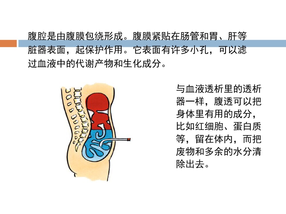 腹膜透析的护理PPT课件下载4