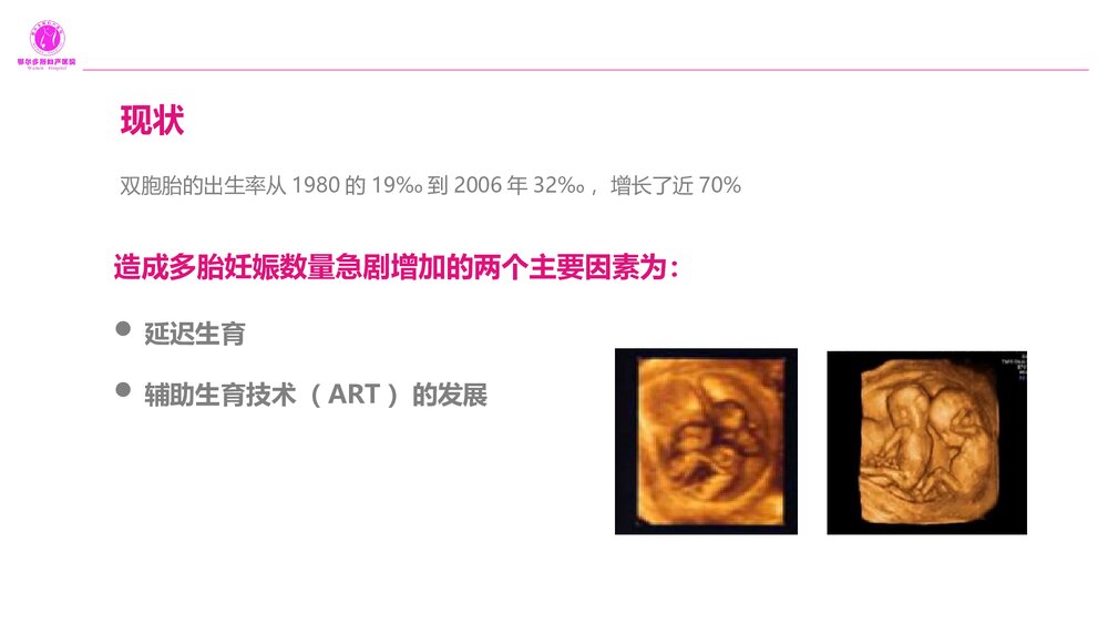 双胎妊娠的产前超声诊断PPT课件2