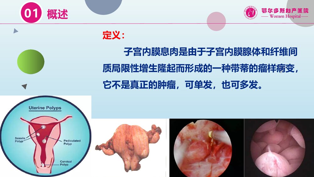 子宫内膜息肉的诊断治疗和复发预防PPT课件3