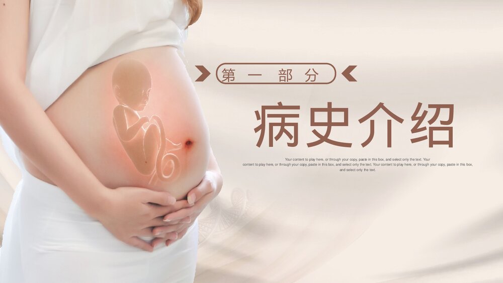 新生儿肺炎护理查房PPT课件下载3