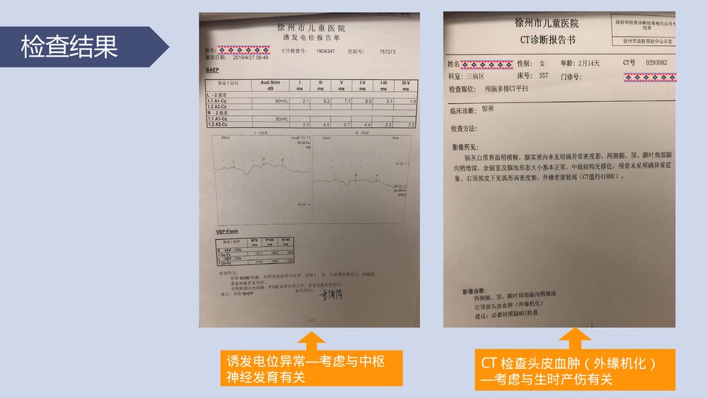 《神经内科》小儿癫痫护理查房PPT课件下载10