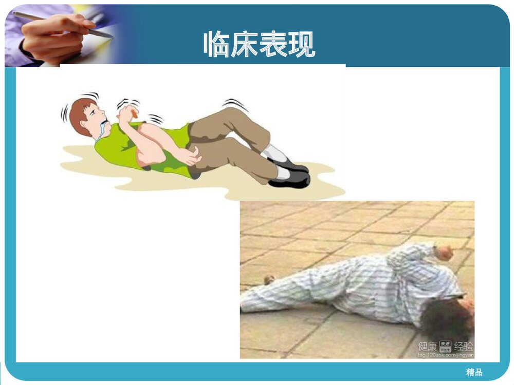 癫痫病人的护理查房PPT课件下载5