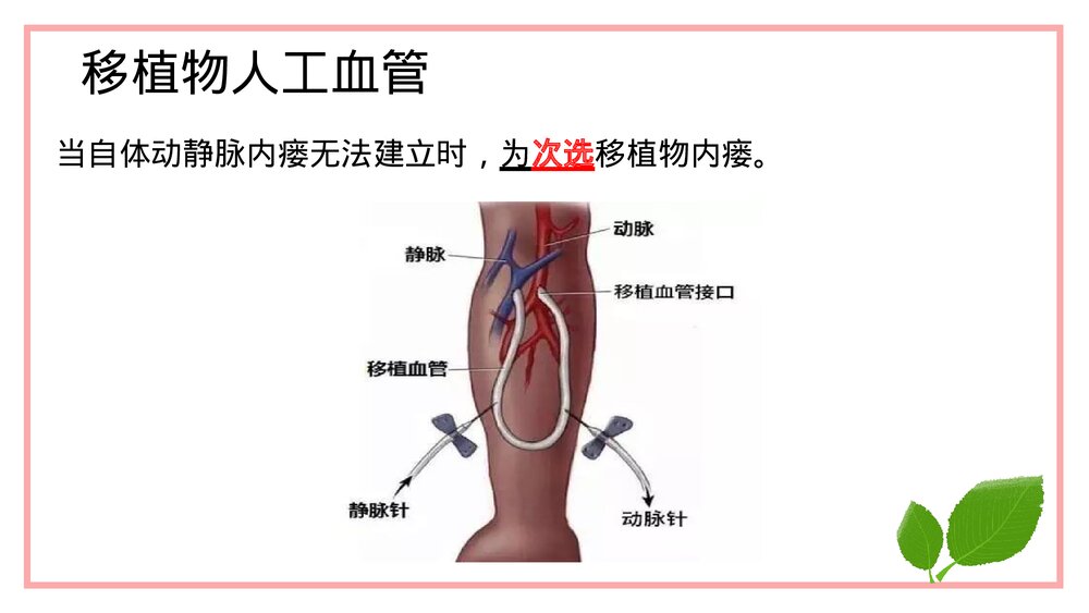 穿刺前对动静内瘘的评估PPT课件下载(共20页·带内容)8