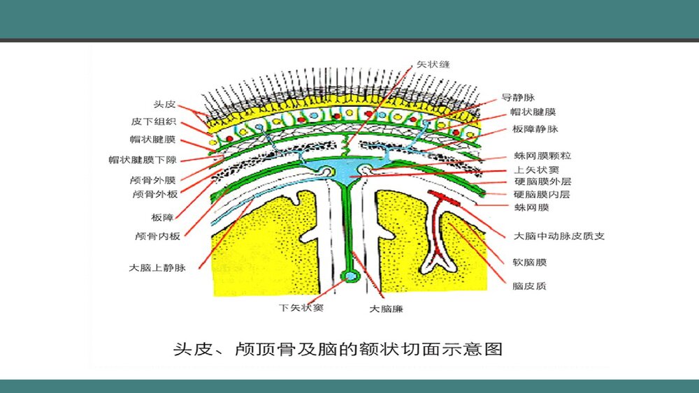 颅脑损伤的手术配合PPT课件下载(共28页·带内容)3