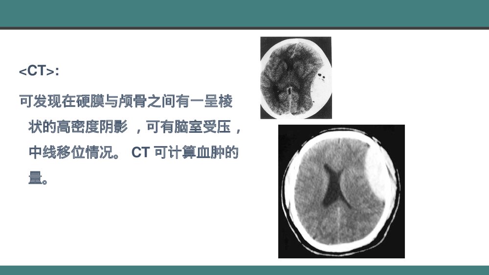 颅脑损伤的手术配合PPT课件下载(共28页·带内容)5