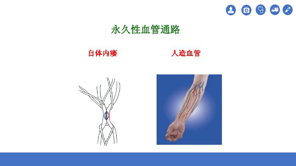 血透患者动静脉内瘘的护理PPT课件(共35页)9