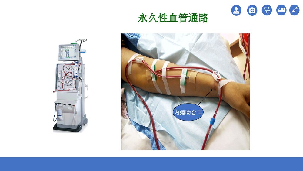 血透患者动静脉内瘘的护理PPT课件(共35页)10