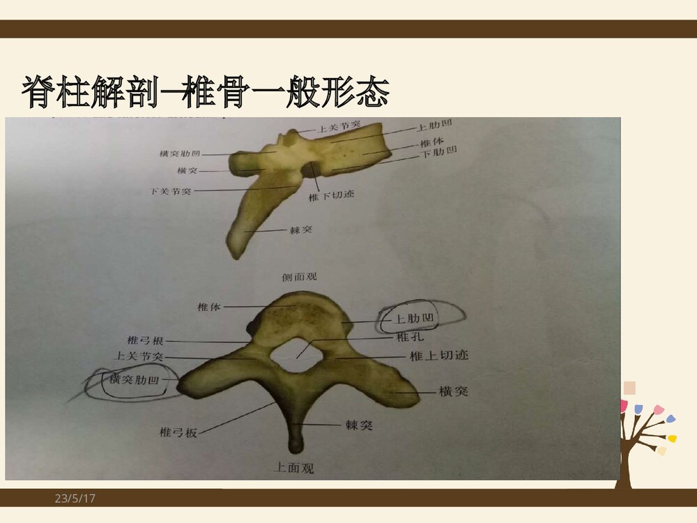 脊柱侧弯矫形术手术配合方法PPT课件(共37页)4