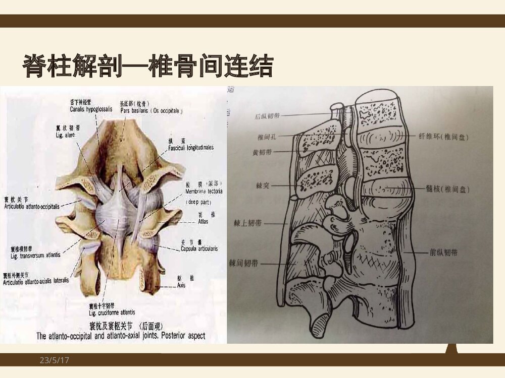 脊柱侧弯矫形术手术配合方法PPT课件(共37页)5