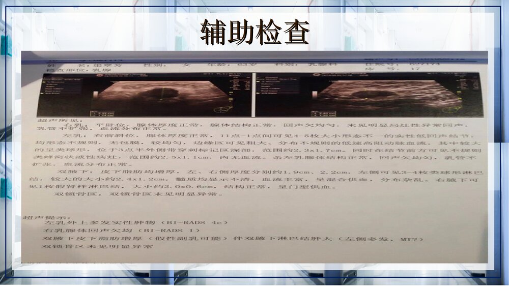 乳腺癌病例讨论PPT课件下载(带内容·共13页)7