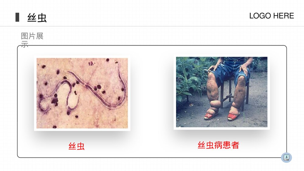 人教版八年级生物上册《线形动物和环节动物》PPT课件(第5.1.2课时)7