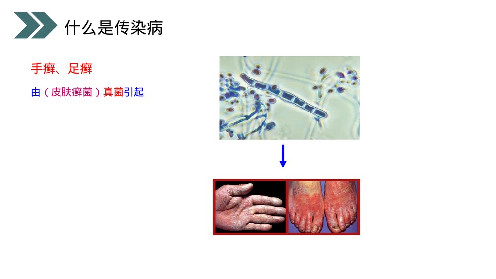 人教版初中生物八年级下册《传染病及其预防》PPT课件10