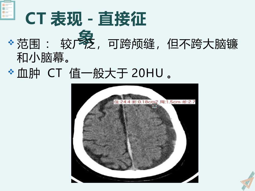 慢性硬膜下血肿的影像诊断与鉴别诊断PPT课件下载(共23页)10