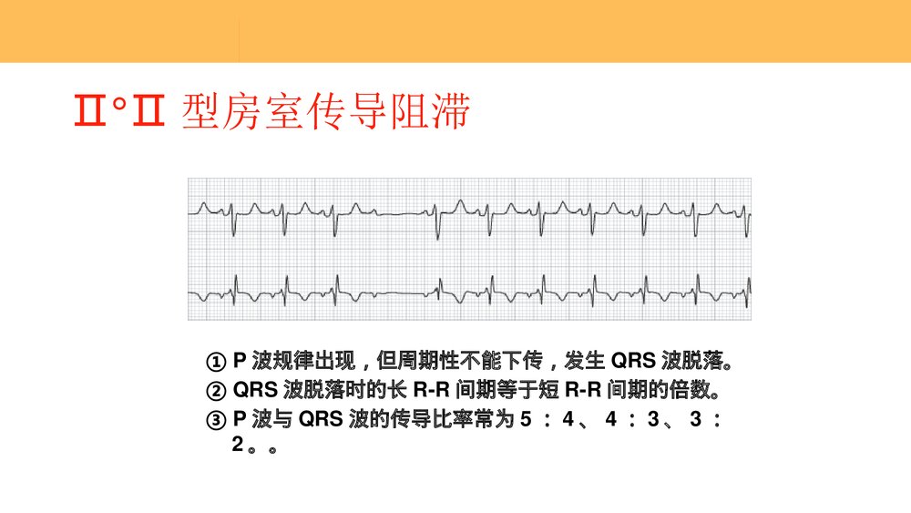 重症患者心律失常的识别和处理PPT课件下载(共59页)9