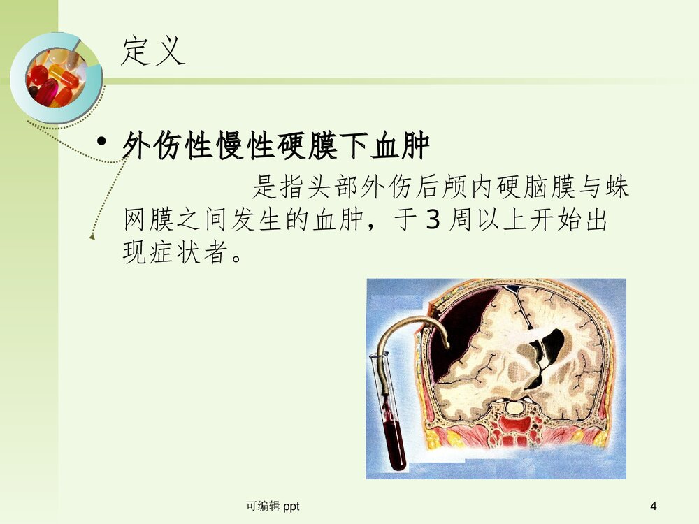 颅脑创伤之慢性硬膜下血肿PPT课件(共42页)4
