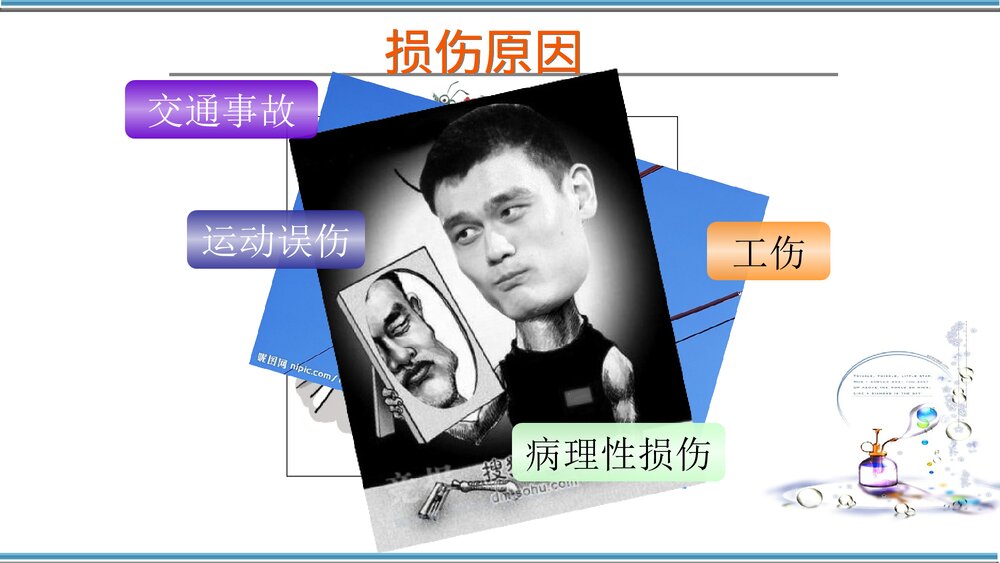 腰椎骨折护理查房PPT课件(共32页)6