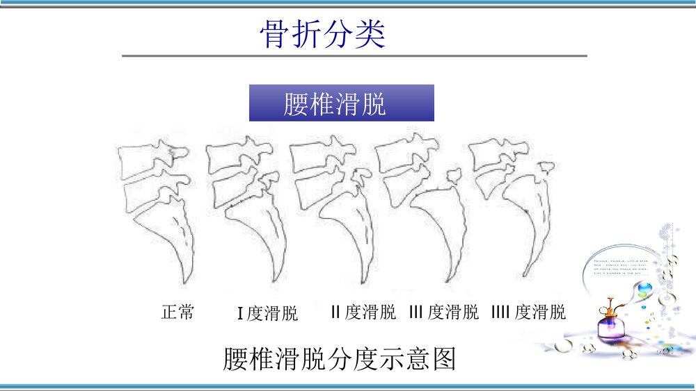 腰椎骨折护理查房PPT课件(共32页)10