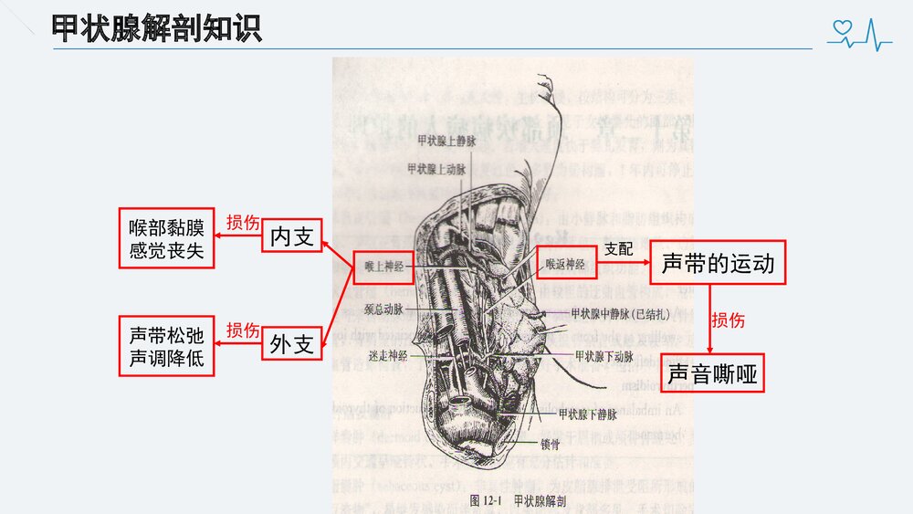 甲状腺次全切术前、术后护理PPT课件下载(共34页)4