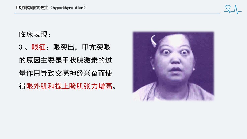 甲状腺次全切术前、术后护理PPT课件下载(共34页)10