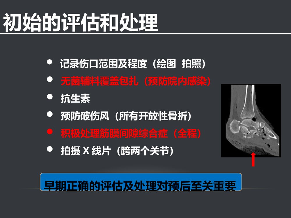 胫腓骨开放性骨折的治疗原则PPT课件(共58页·可编辑修改)5