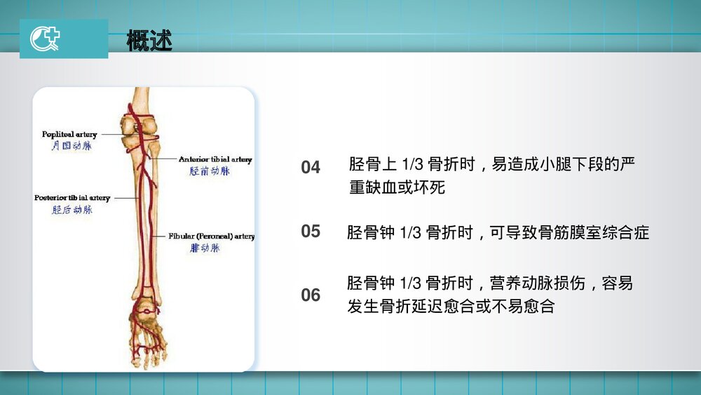 胫腓骨骨折的护理PPT课件(共23页·可编辑修改)7