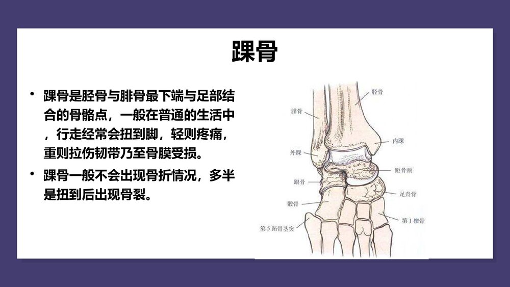 三踝关节骨折护理查房PPT课件（共29页）2