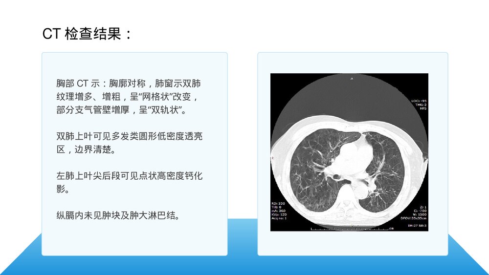 呼吸衰竭护理查房及案例分析PPT课件下载6