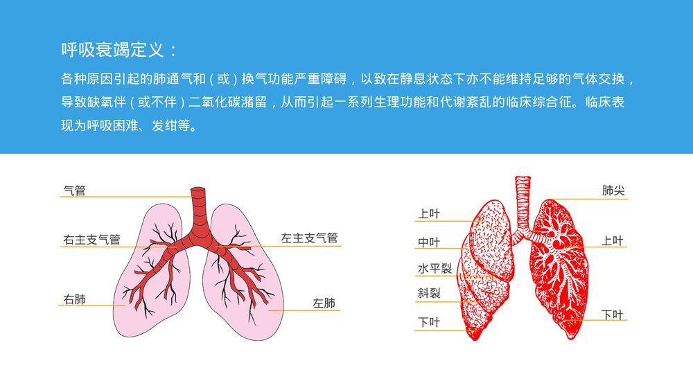 呼吸衰竭护理查房及案例分析PPT课件下载7