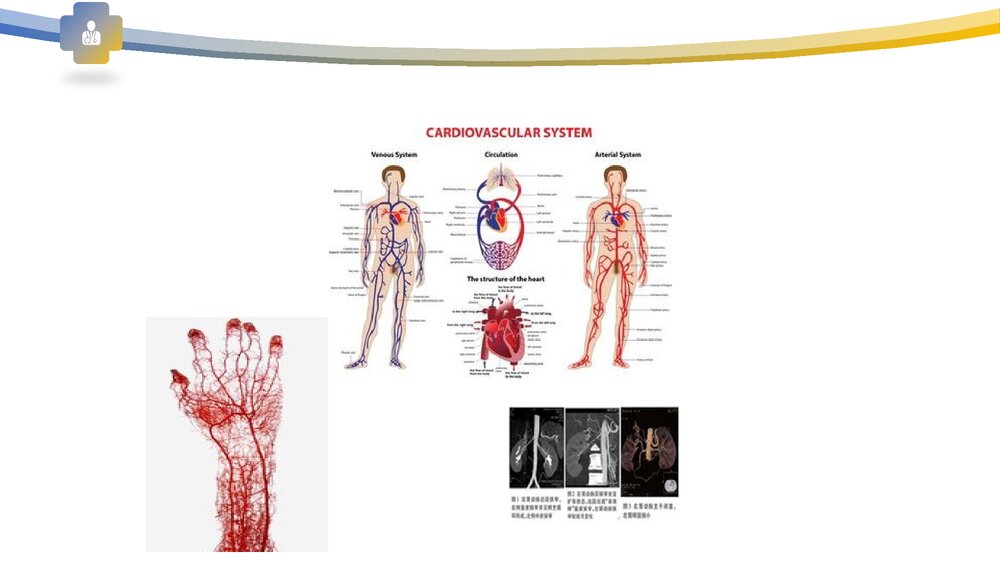 血管病变及防治PPT课件下载3