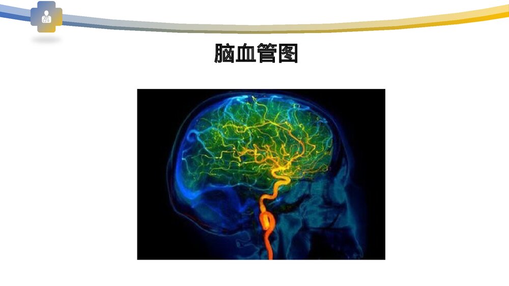 血管病变及防治PPT课件下载4