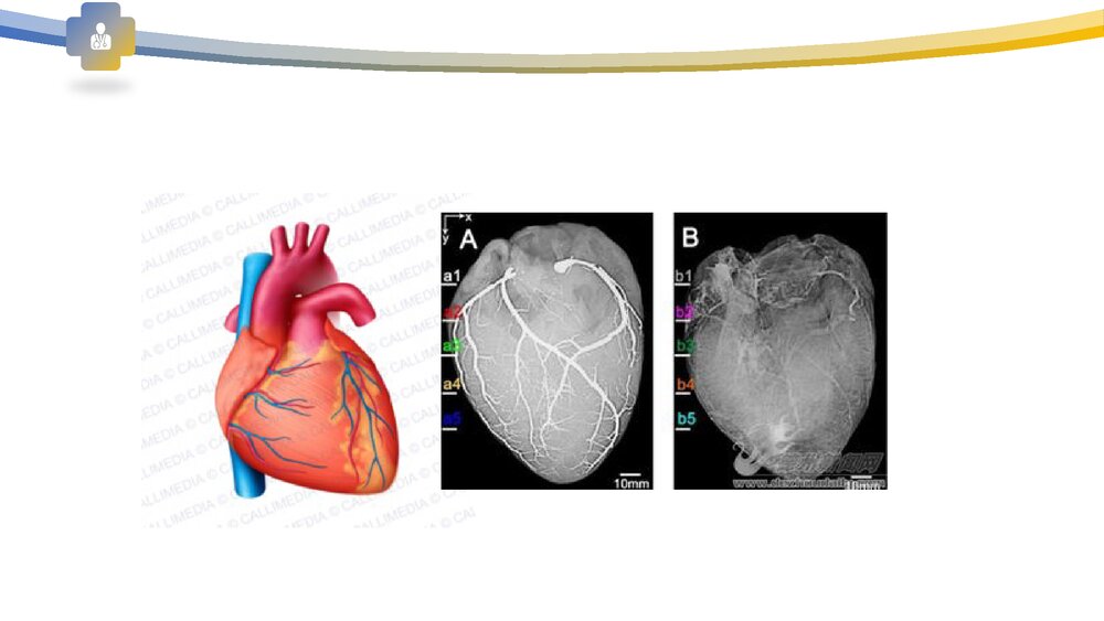 血管病变及防治PPT课件下载6