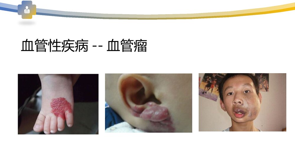 血管病变及防治PPT课件下载9